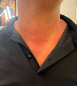 eliene-massoterapeuta-em-salvador_31_03_2026_04